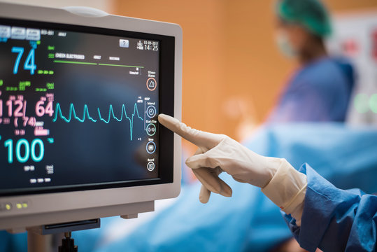 ECG